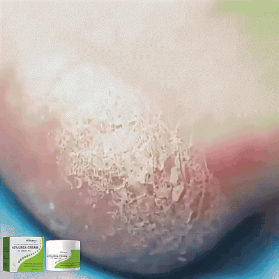 <p>Watch It Melt Into Dry, Cracked Skin</p>