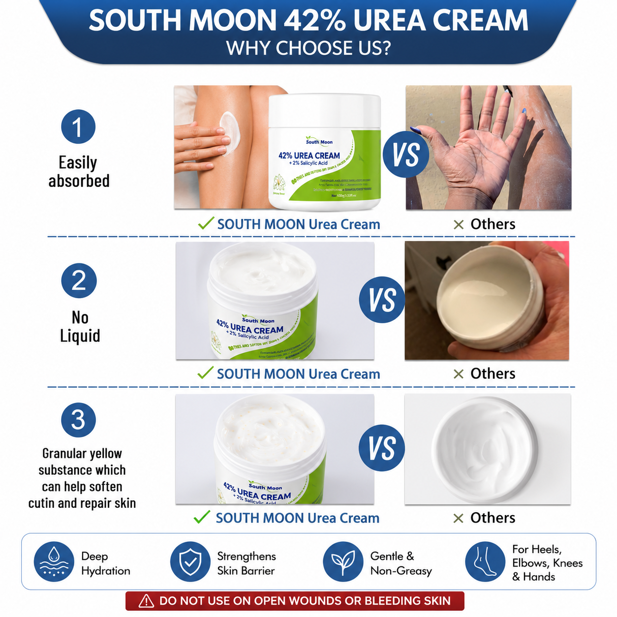 42% Urea Cream for Dry, Rough & Cracked Skin (100g)