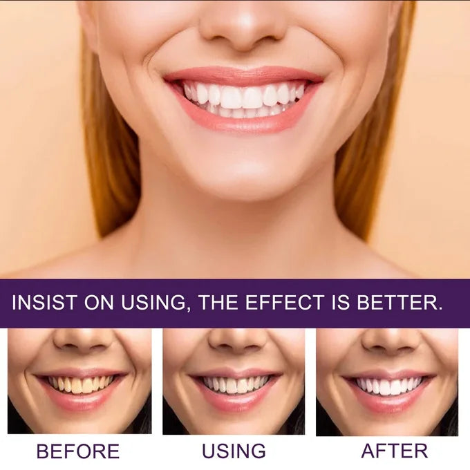 Purple Whitening Toothpaste | Color Correcting Teeth Brightener