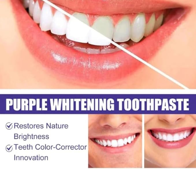 Purple Whitening Toothpaste | Color Correcting Teeth Brightener
