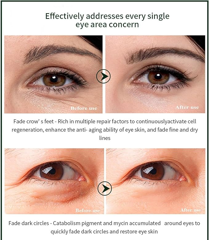 Time Eraser Eye Essence Oil – Hydrating Under Eye Care (10ml)