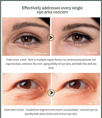Time Eraser Eye Essence Oil – Hydrating Under Eye Care (10ml)